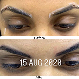 Eyebrow Makeover Before After