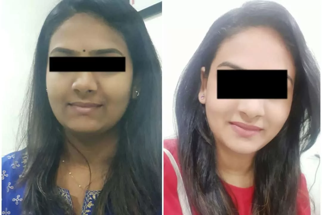 skin whitening results