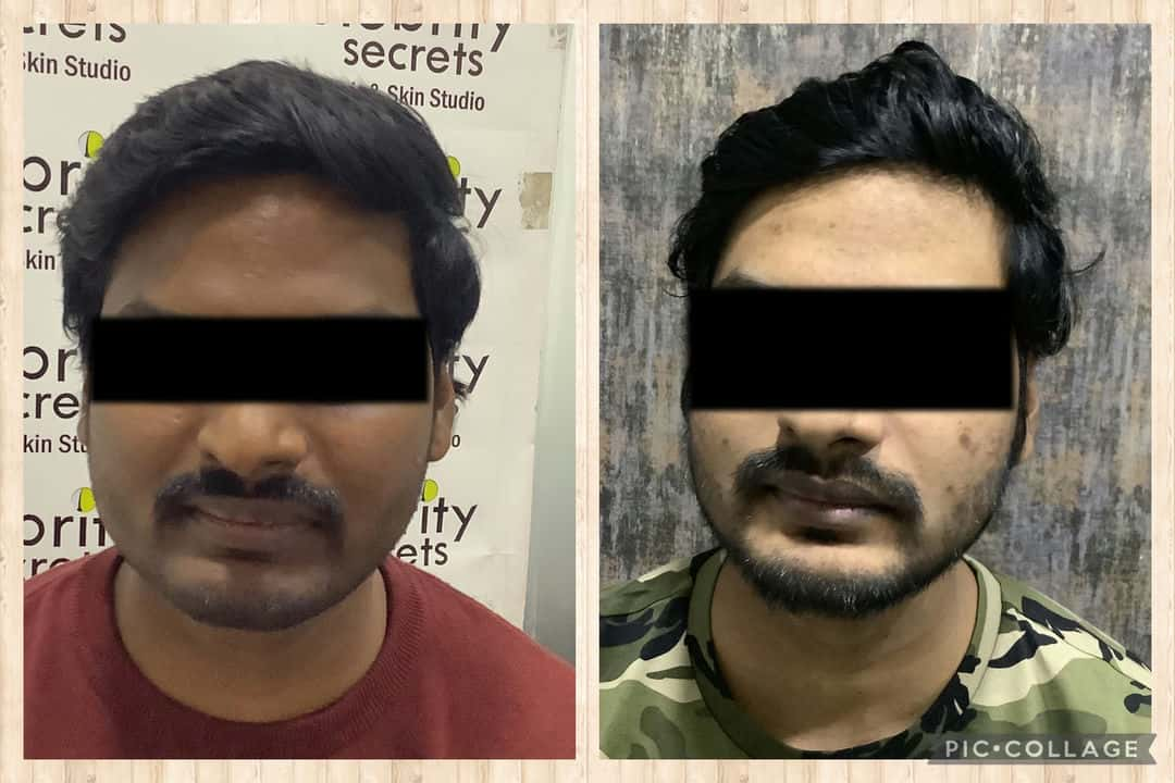 skin whitening results