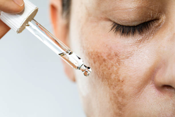 skin whitening